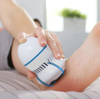 General Goods Galore™ Vacuum Callus Remover